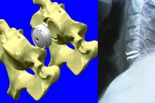 Un arrêté du Conseil d'Etat fixe dans le canton de Vaud un nombre maximal de neurochirurgiens, de cardiologues, d'urologues et d'ophtalmologues (photo prétexte). KEYSTONE/AP UNIKLINIK MAGDEBURG
